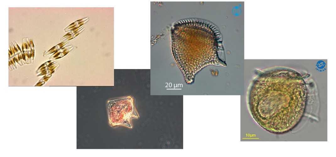 Mikrobiyoloji Analiz Laboratuvarımızda, ISO 15204 metoduna göre Deniz Sularında Toksik Fitoplankton sayımı analizine başlanmıştır. (23.06.2025)