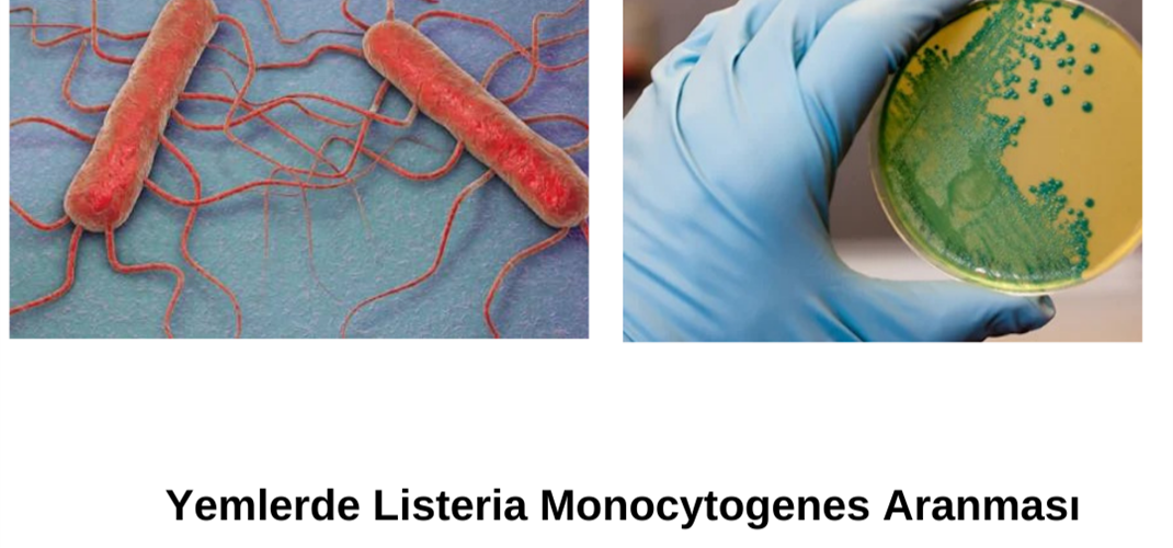 YEMLERDE LİSTERİA MONOCYTOGENES ARANMASI ANALİZLERİNE BAŞLANMIŞTIR